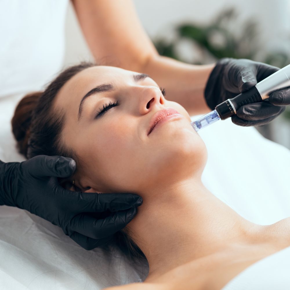 Tratamiento Facial con Dermapen